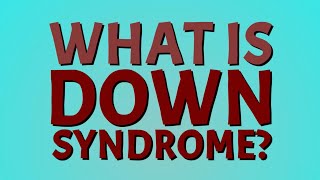 What is Down Syndrome Down syndrome trisomy 21 [upl. by Pettit510]