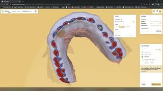 Updated Clinux splint design workflow [upl. by Rafat]