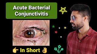 Acute bacterial Conjunctivitis lecture opthalmology [upl. by Tymothy]