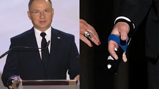 Andrzej Duda kontuzjowany Co na to lekarz quotNie był to mały urazquot [upl. by Lorita]