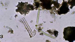 珪藻や緑藻たちの静かな世界A stilllife view of algae and diatoms [upl. by Uyr]