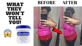 ALBOLENE 30 MINUTE WEIGHT LOSS  GBFWG [upl. by Oicnecserc64]