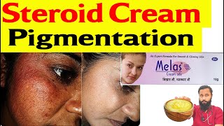 Steroid cream Side effect on face  Pigmentation कैसे ठीक करें ॰॰ Dr Prateek chauhan [upl. by Liu]