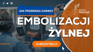 EMBOLIZACJA ĹťYLNA  jak przebiega zabieg [upl. by Birck569]