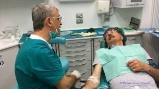 Sedazione cosciente endovenosa e iatrosedazione in pz ansiosofobico [upl. by Haram]