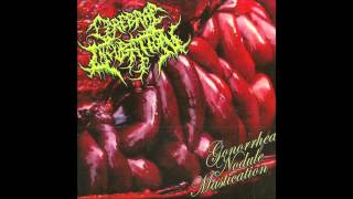 Cerebral Incubation  Gonhorrea Nodule Mastication Full Album 2012 HD [upl. by Eytteb]