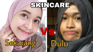 MY SKINCARE ROUTINE quotDULUquot VS quotSEKARANG UNTUK KULIT BERMINYAK BERJERAWAT [upl. by Nolita929]