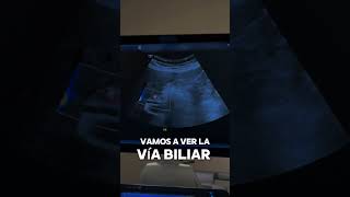 Tips para evaluar la vía biliar en ecografía shorts [upl. by Narih]