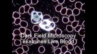 Live Blood Analysis Dark Field Microscopy explained [upl. by Glorianna]