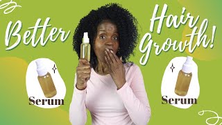 4 Ways to Take Care of Your Hair  How to make Thin to Thick Hairs Hair Growth Tips [upl. by Nnagem]