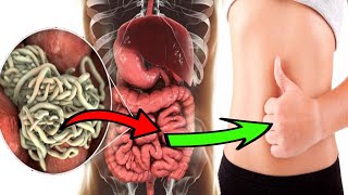 How To Get Rid of Intestinal Stomach Worms Naturally PARASITES [upl. by Teryl]