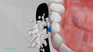 How to Brush Your Teeth Correctly StepbyStep Animation for a Healthier Smile [upl. by Happy]