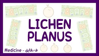 Lichen planus  definition pathophysiology types clinical picture diagnosis amp treatment شرح عربي [upl. by Acisey807]