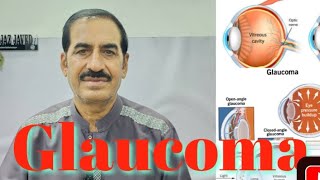 Eye  Glaucoma کالا موتیا Diagnosis Prevention and Treatment [upl. by Arratoon784]