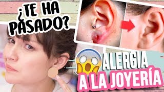 TIPS para la ALERGIA A LA JOYERÍA  ALERGIA AL NÍQUEL  MI HISTORIA [upl. by Rratsal131]