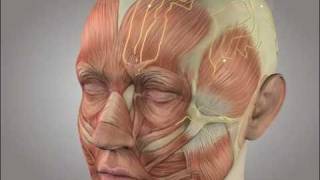 Migraine surgery video animation [upl. by Ayital]