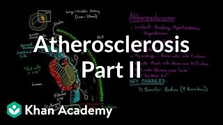 Atherosclerosis  part 2  Circulatory system diseases  Health amp Medicine  Khan Academy [upl. by Limann]