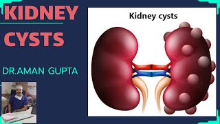 Renal or Kidney CystsSymptomsCauseTreatment [upl. by Aniat]