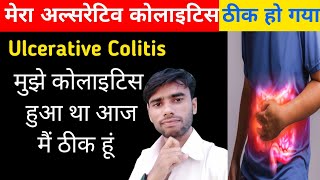 गंभीर बीमारी Ulcerative Colitis ठीक हो गये 💪😇 ulcerative colitis treatment in hindi [upl. by Tracay]