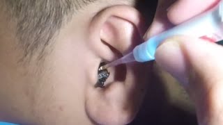 Massive Earwax Removal in One Piece The Best Technique [upl. by Macdonald124]