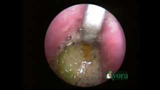 Foreing body apple esophageal in dog [upl. by Ashmead]