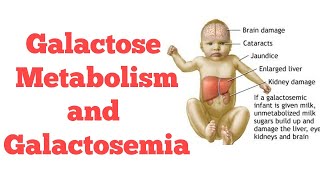 Galactose metabolism  Biochemistry [upl. by Iraam245]