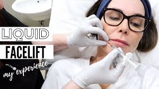 Getting Cheek Filler  Anti Aging Treatment Over 50 [upl. by Yawnoc956]