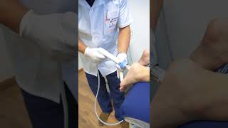 Fascitis Plantar Tratamiento con Ondas de Choque [upl. by Harragan]