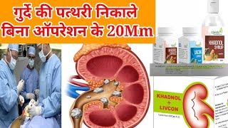 KHADNOLLIVCON CAPSULE amp SYRUP Review in Hindi पथरी निकाले बिना ऑपरेशन से [upl. by Aracaj338]