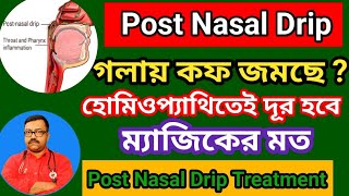 গলায় কফ জমে   হোমিওপ্যাথিতেই দূর হবে ম্যাজিকের মত  homeopathy medicine for Post Nasal Drip [upl. by Notnats608]