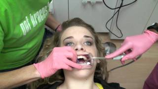 Nice Teeth Bro Removal of Braces [upl. by Chip]