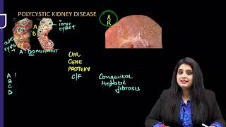 RENAL PATHOLOGY RAPID REVISION FMGEINICET NEET PG [upl. by Herbst610]