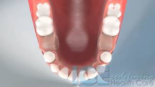 Dental Development Lower Occlusal View [upl. by Arno]