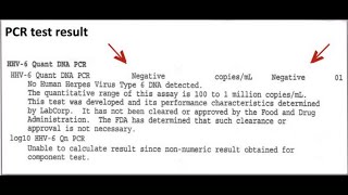 Human Herpesvirus 6 PCR Test  NEGATIVE Following Scalar Light Sessions [upl. by Sirromed894]