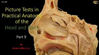 Picture tests in head and neck anatomy 9 [upl. by Artus612]