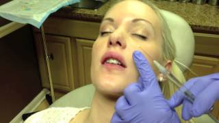 Botox amp Juvederm Lip Injection in Virginia by Dr Naderi DC VA MD [upl. by Aierbma725]