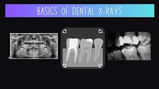 Basics of Dental Xrays [upl. by Chevy]