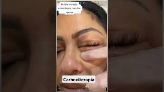 Carboxiterapia ideal para las ojeras [upl. by Caddric814]