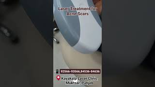 Acne Scar Removal  Face Laser Treatment [upl. by Aiuqet]