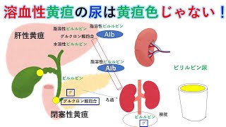 国試対策：暗記からの卒業 42話 ビリルビン代謝と黄疸 [upl. by Kamila249]