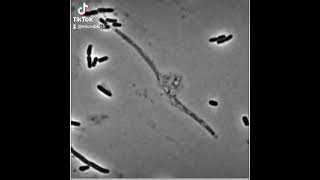 🚨Un Bacteriofago lisando a una Escherichia coli 🦠 [upl. by Weston]