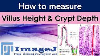 Measurement of villus height and crypt depth with ImageJ  Morphometry of intestine [upl. by Ettenotna]