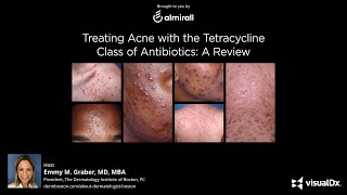 Treating Acne with the Tetracycline Class of Antibiotics A Review [upl. by Abagael]