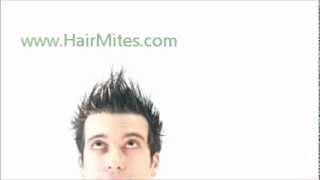 Hair mites hair loss [upl. by Hadrian]