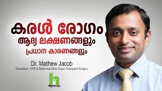 കരൾ രോഗത്തിന്റെ ഈ ലക്ഷണങ്ങൾ സൂക്ഷിക്കുക  Liver Disease Malayalam Health Tips [upl. by Devinne]