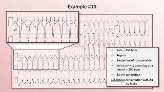 Intro to EKG Interpretation  Practicing Tachyarrhythmia Identification [upl. by Avert]