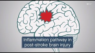 cGAScGAMPSTING signaling mediates brain injury after subarachnoid hemorrhage [upl. by Ylrebmek174]