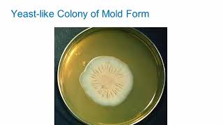 Dimorphic Fungi Sporothrichosis Hot Topic [upl. by Erapsag]