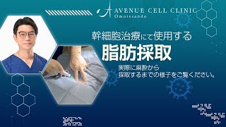 幹細胞治療の脂肪採取について【アヴェニューセルクリニック】 [upl. by Ahsitul]