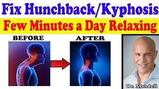 Fix HunchbackKyphosis in Just a Few Minutes a Day While Relaxing  Dr Alan Mandell DC [upl. by Spooner753]